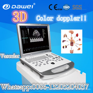 prix de machine d&#39;échographie portative et scanner d&#39;échographie d&#39;ordinateur portable 3D
